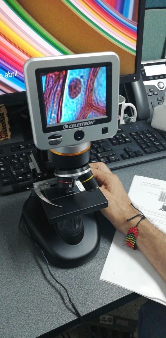 Celestron TetraView LCD Digital Microscope with 180 Degree Swivel Screen, Digital Microscope with LCD Screen for Classroom or Lab, Capture Photos & Video, Up to 1600x Power, Great for Students customer photo 1