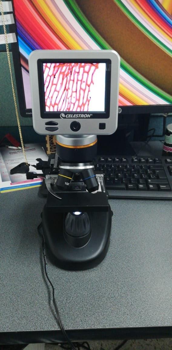 Celestron TetraView LCD Digital Microscope with 180 Degree Swivel Screen, Digital Microscope with LCD Screen for Classroom or Lab, Capture Photos & Video, Up to 1600x Power, Great for Students customer photo 2
