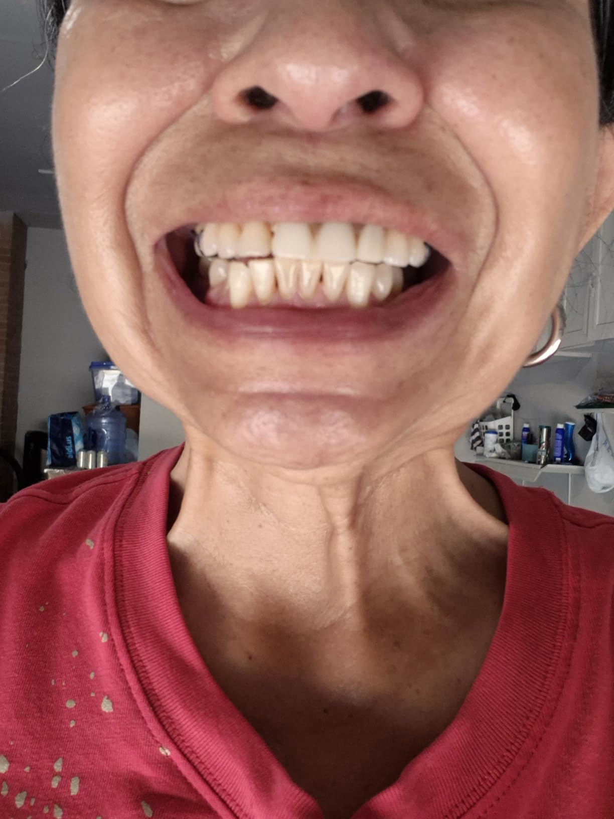 Crest 3D Whitestrips Professional Effects + LED Light - Teeth Whitening Kit, 1 Light + 20 Treatments, Each with 1 Upper/1Lower, 40 Strips customer photo 2