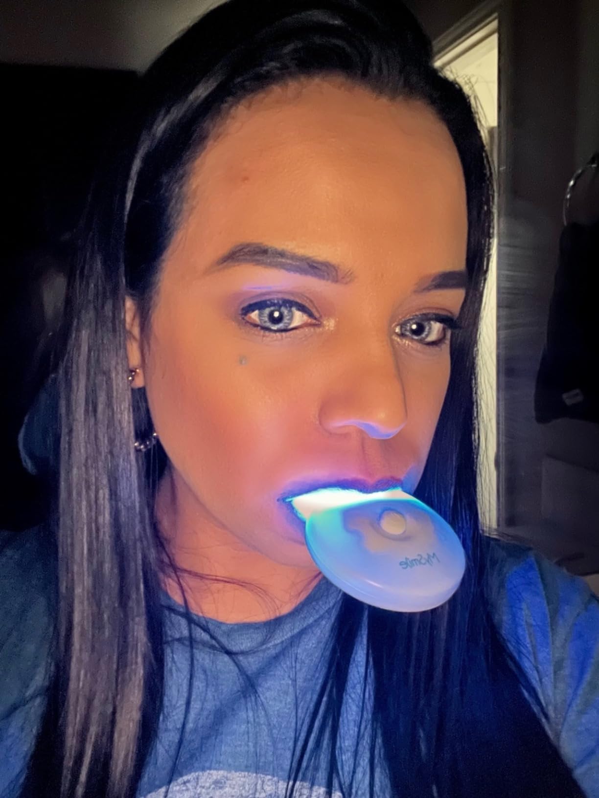 MySmile Teeth Whitening Accelerator Light, 28 LED Blue Light, Each 10 Minutes, USB Charger, Mouth Trays, 1 Pcs LED Light & 4ml Gel customer photo 1