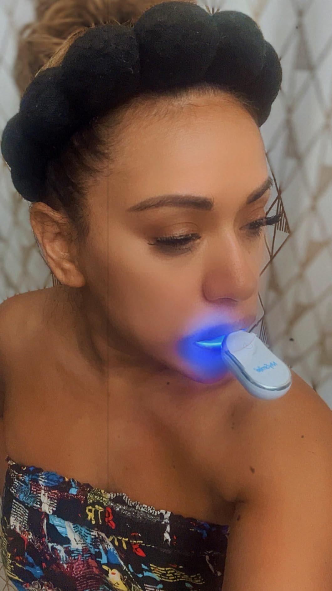 MySmile Teeth Whitening Kit for Sensitive Teeth, 30+ Treatments Whitener | 4*3ml 35% Carbamide Peroxide Whitening Gel + 4ml Remineralization Pen & 28LED Whitening Tray Light, Remove Years of Stains customer photo 2