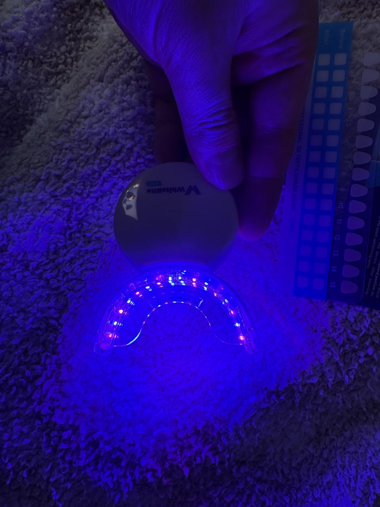 Whitebite Pro Teeth Whitening Kit for Sensitive Teeth - 32X LED Light + 35% Carbamide Peroxide Gel + Remineralizing Gel - Dental-Grade Whitening at Home customer photo 2