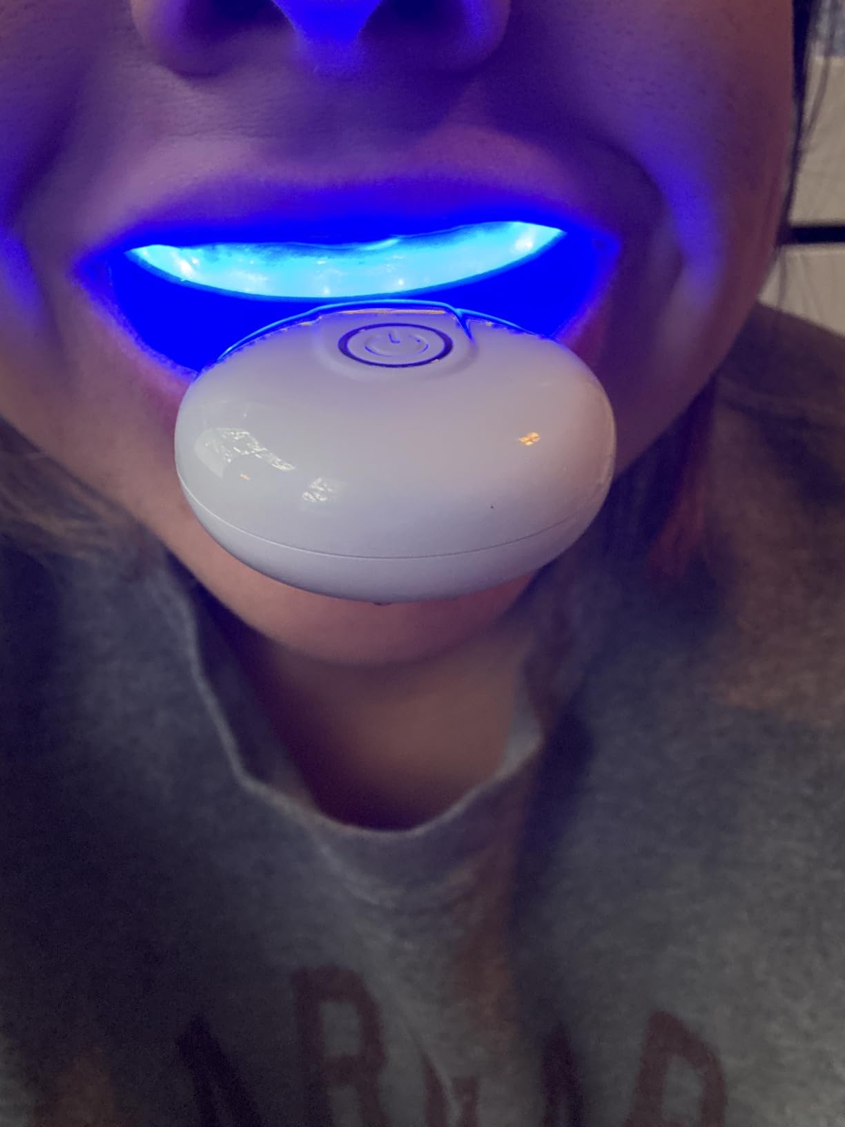 GuruNanda Teeth Whitening Kit, Up to 10 Shades Whitening, 40 Treatments | Wireless Led Accelerator Teeth Whitener|Comes with 8% Hydrogen Peroxide Teeth Whitening Gel Pen & Teeth Whitening Strips customer photo 2
