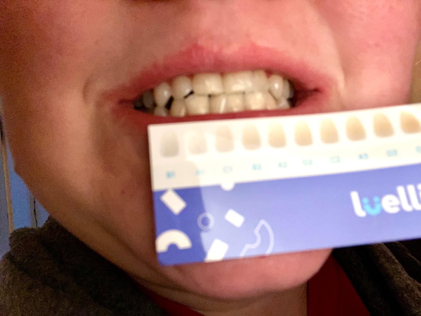 Luelli Teeth Whitening Kit with 35% Carbamide Peroxide - Teeth Whitener for Sensitive Teeth | Enamel Safe - 32 LED Lights - Wireless with Tray and Whitening Gel Pen for Home | Travel (Mint) customer photo 1
