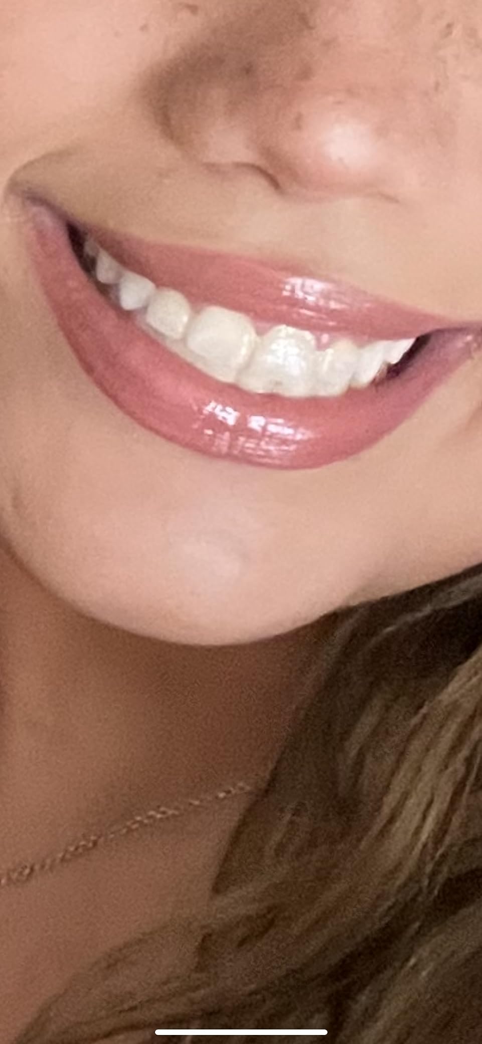 Purple Teeth Whitening Strips - 28 Teeth Whitener Strips (14 Uses) | Purple Color-Correcting Gel Technology | Teeth Whitening Kit for Sensitive Teeth | Enamel Safe, Peroxide-Free for a Brighter Smile customer photo 1