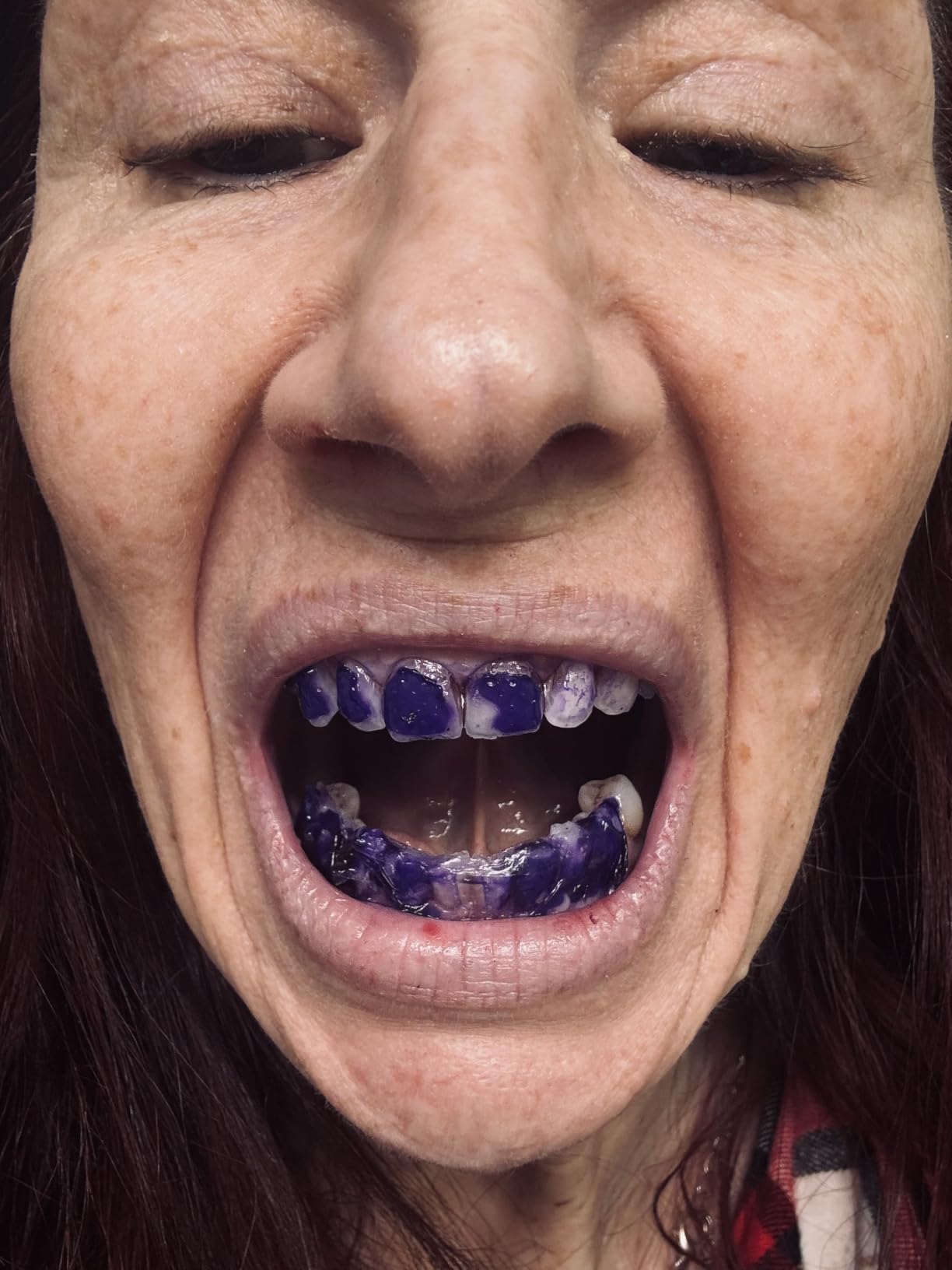Purple Teeth Whitening Strips for Sensitive Teeth 28 Count Whitener Strips - Tooth Whitening Strips with Non Slip & Enamel Safe & Non Sensitive, Teeth Whitening Kit for Coffee Wine Stains Removal customer photo 1